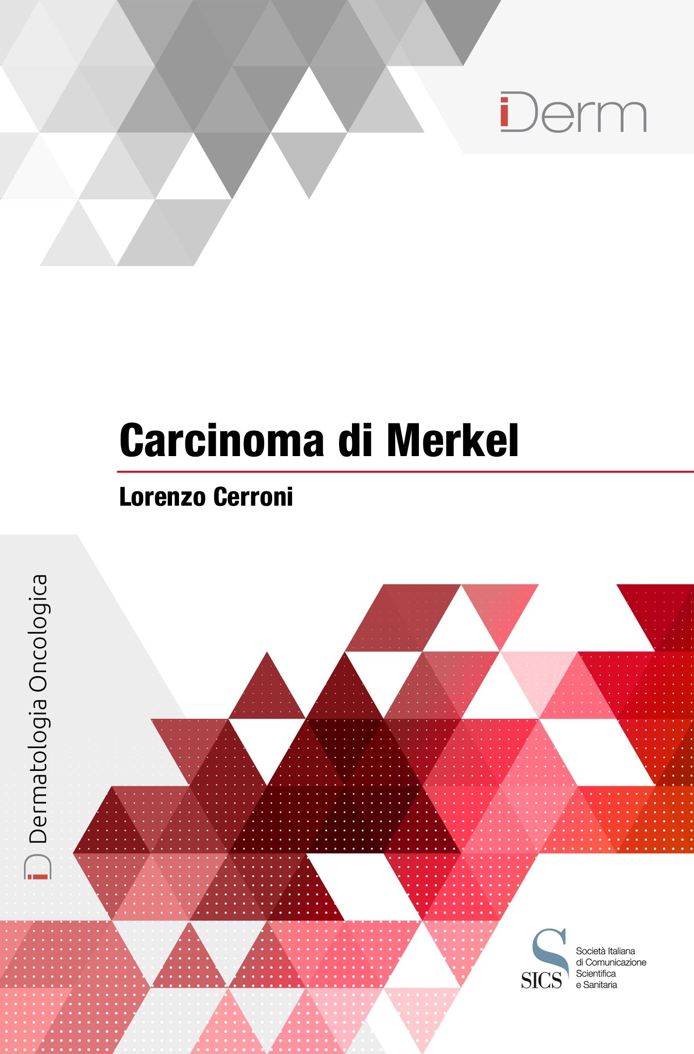Carcinoma di Merkel