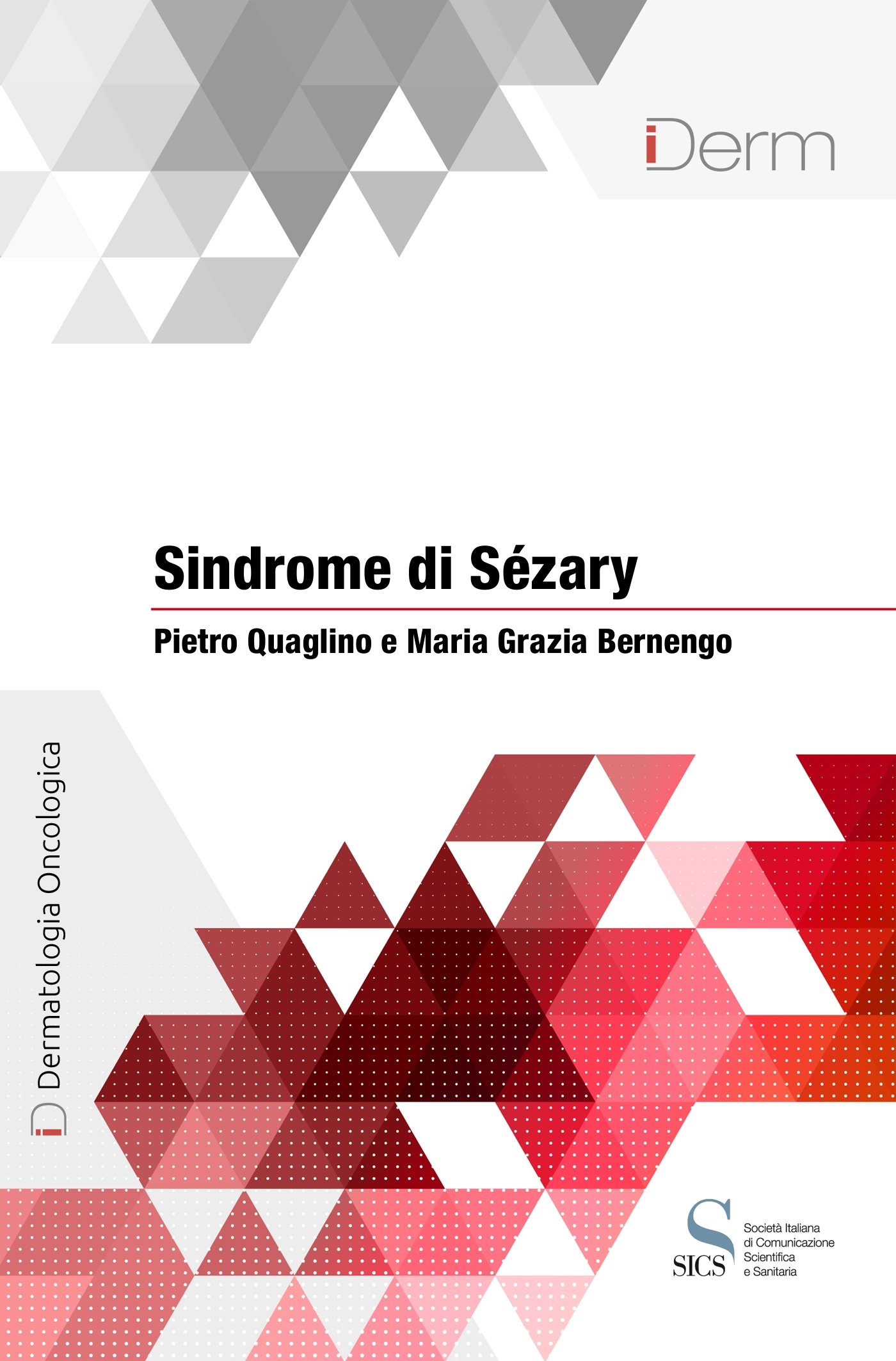 Sindrome di Sezary
